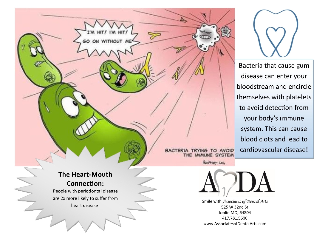 Associates of Dental Arts Blog Gum Disease Linked to Blood Clots
